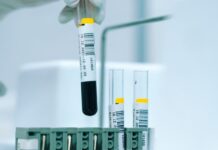 En pahalı İlaç: Zynteglo Gen tedavisi bir doz için 2,8 milyon dolara mal oluyor The most expensive Medicine Zynteglo cell gene therapy-min