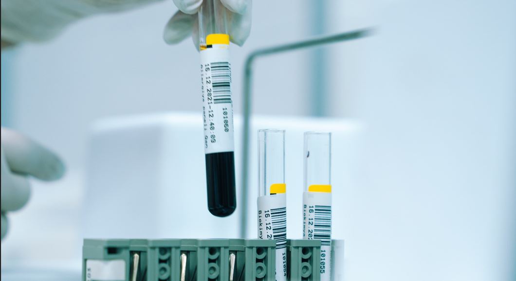 En pahalı İlaç: Zynteglo Gen tedavisi bir doz için 2,8 milyon dolara mal oluyor The most expensive Medicine Zynteglo cell gene therapy-min