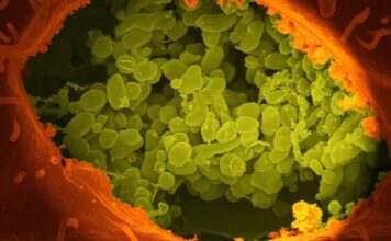 Bazı bağırsak bakterileri yiyeceklerden daha fazla enerji çıkarabiliyor Some gut bacteria can extract more energy from food