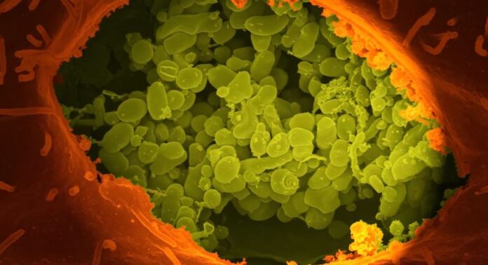 Some gut bacteria can extract more energy from food